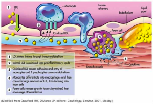 ldl_mechanisms oxidation in vessel wall